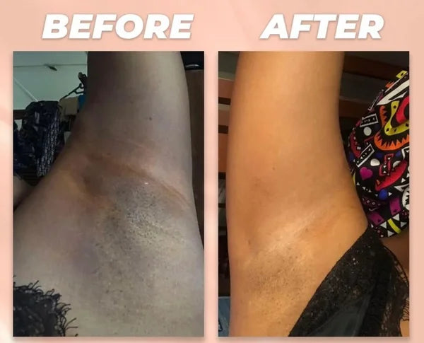 DARK ARMPIT INNER TIGH ERASER