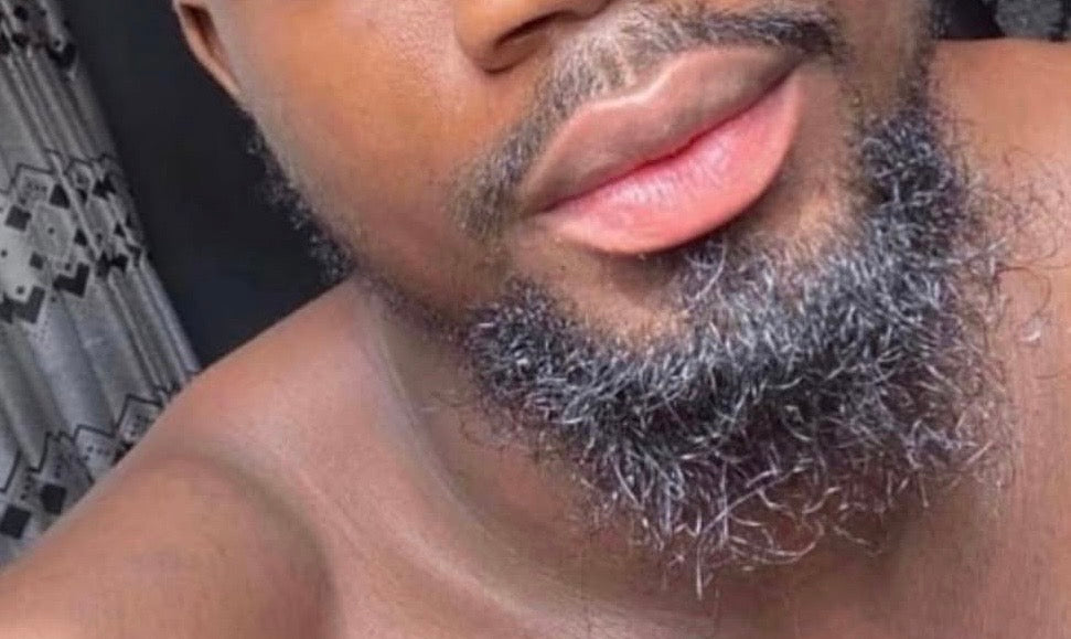 Lip Lightening Treatment