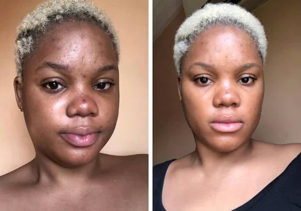 2x LIGHTNING FACE CREAM SET